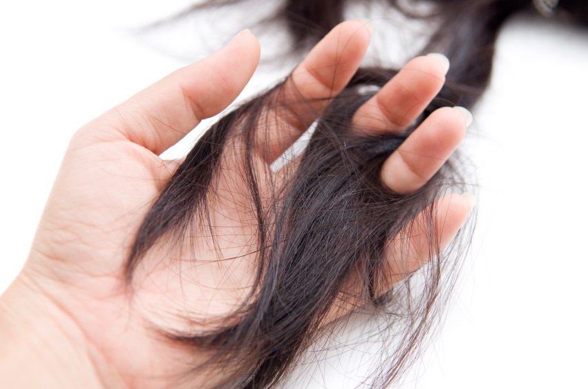 What Are The Signs That Your Hair Is Falling Out?